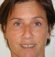 /album/galleria-foto-trucco-permanente/maggio-2012-23-jpg/